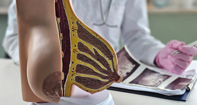 Діагностика кісти молочної залози