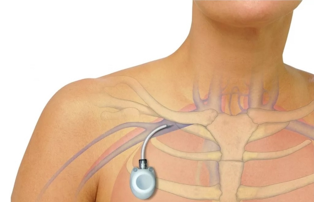 Що таке порт-система