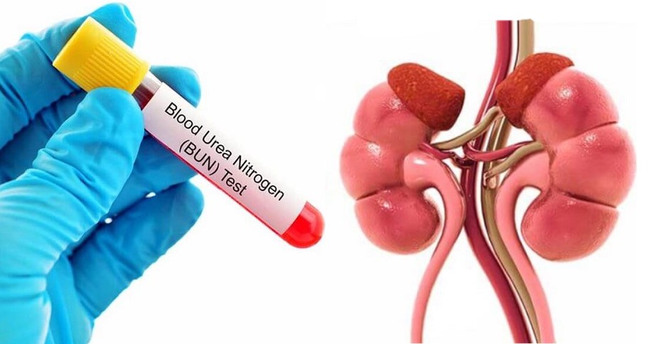 Діагностика захворювань нирок 