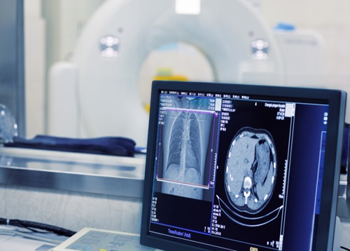 Розшифровка результатів КТ серця та коронарних артерій у кардіолога