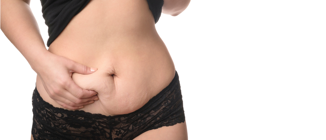 обвисла шкіра після схуднення