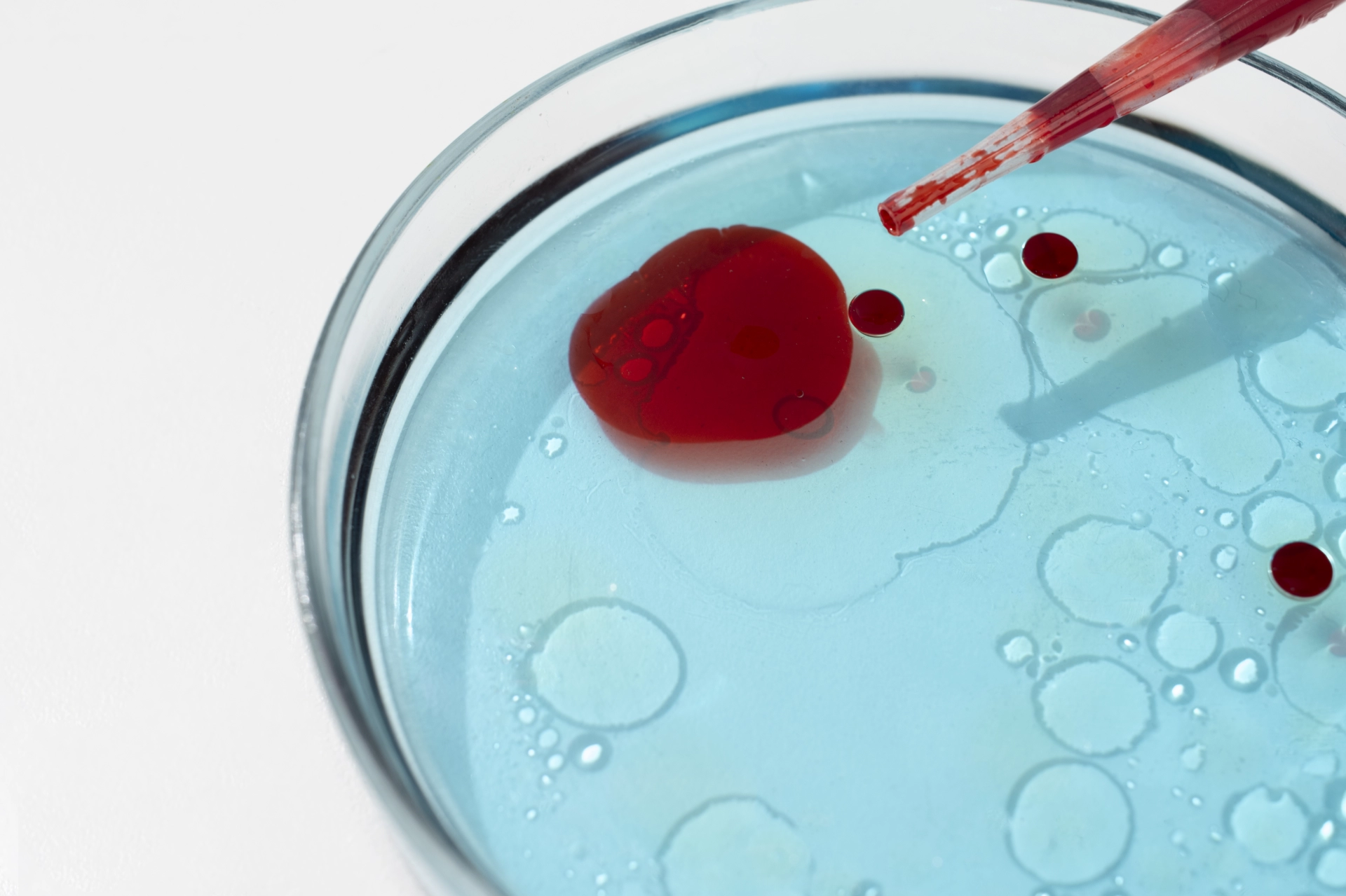 Що таке коагулограма