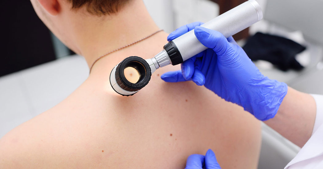 Діагностика плоскоклітинного раку шкіри