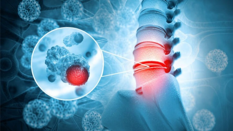 Причини саркоми