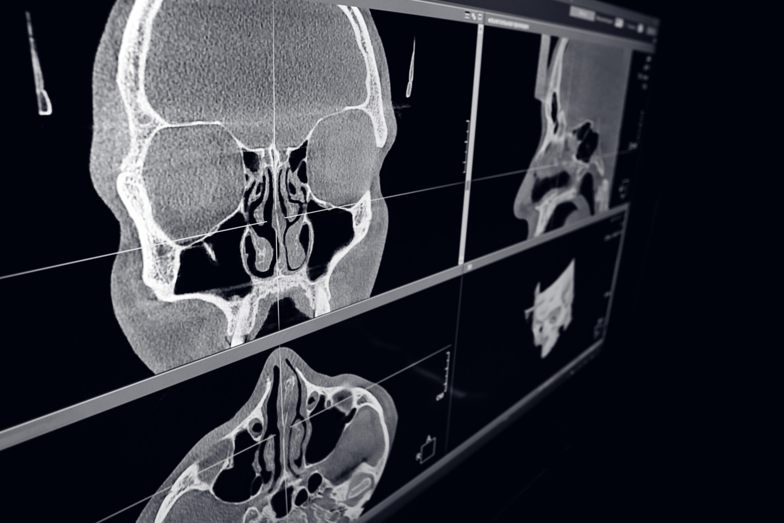 Що показує КТ ЛОР-органів