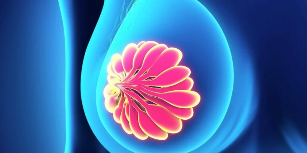 що таке мастит