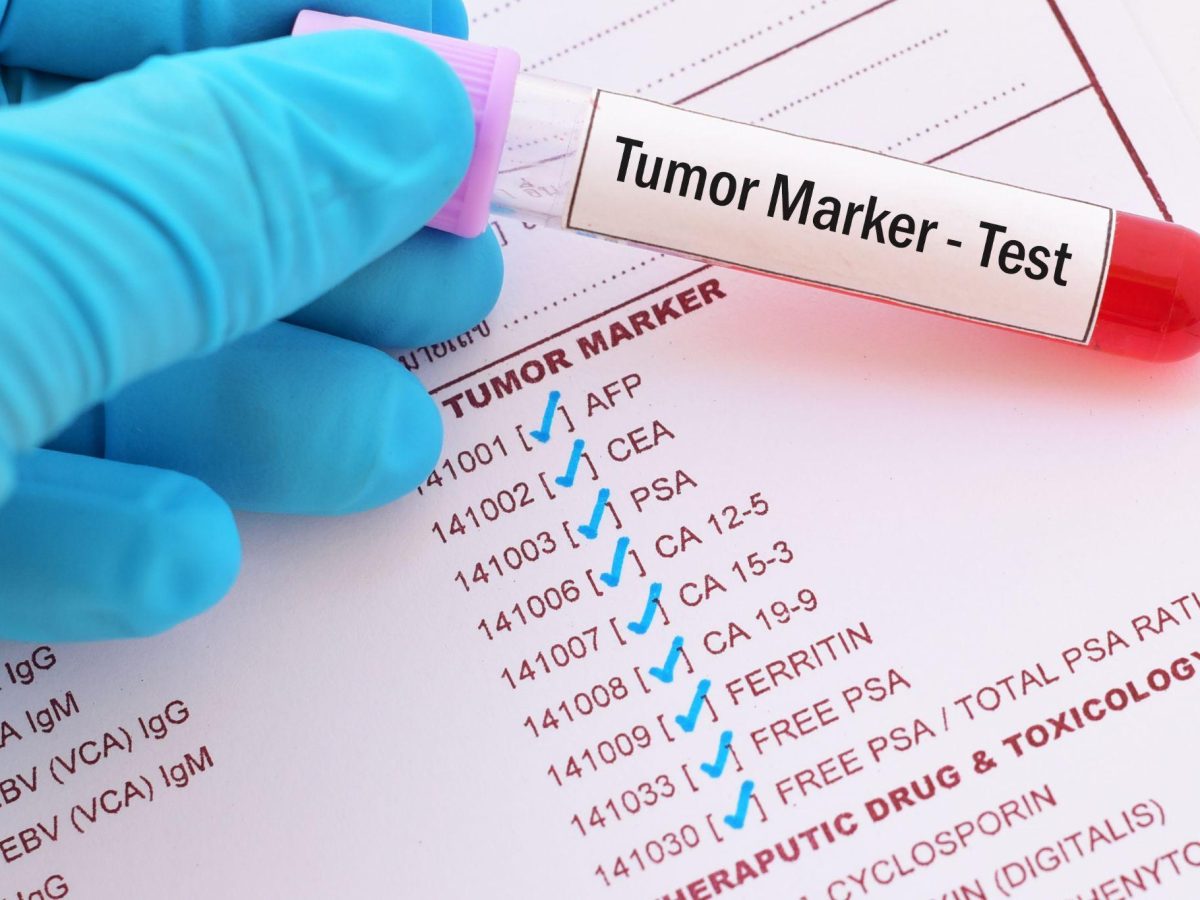 Зразок венозної крові для аналізу на онкомаркери