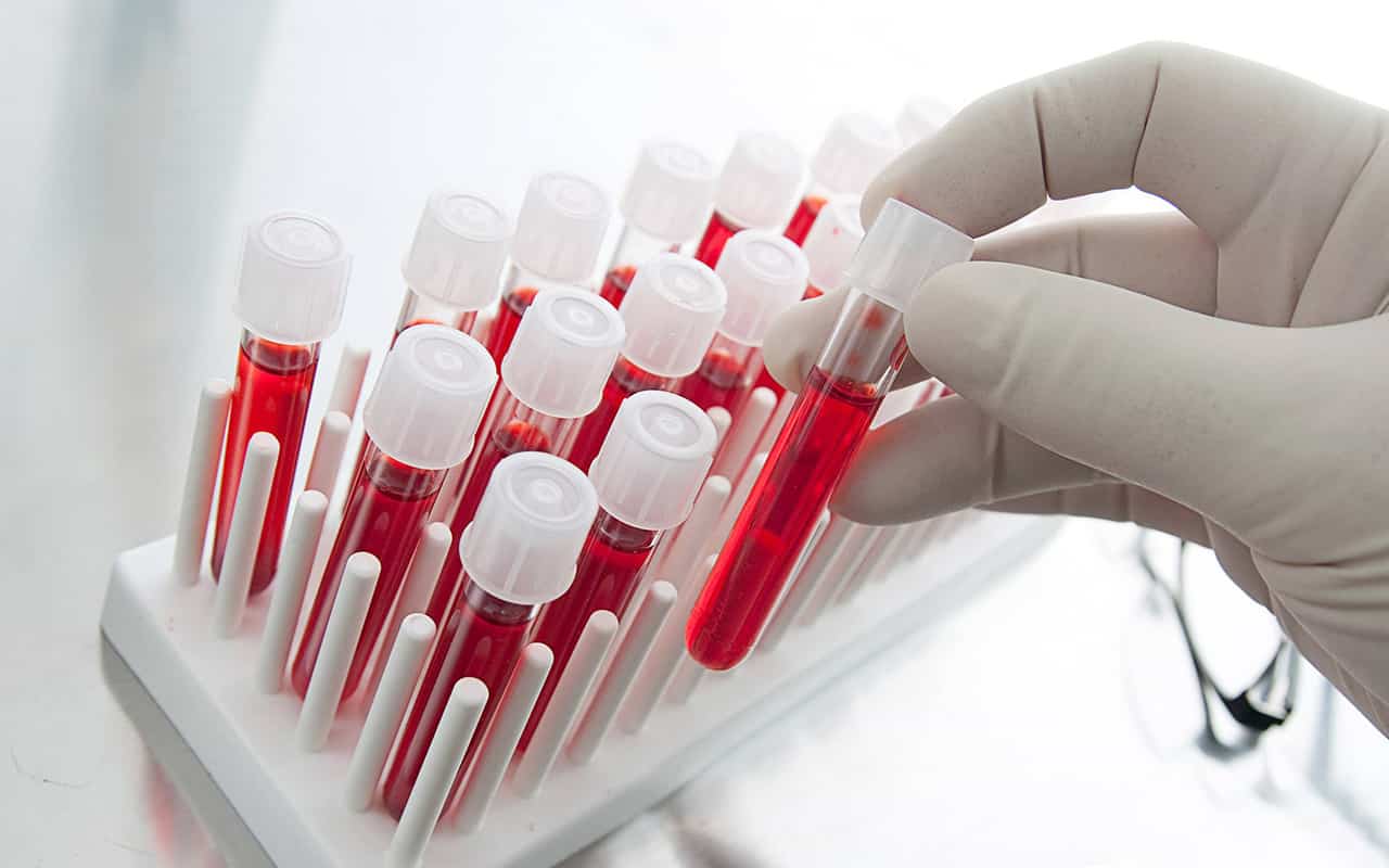 Зразки венозної крові для аналізу на гормони