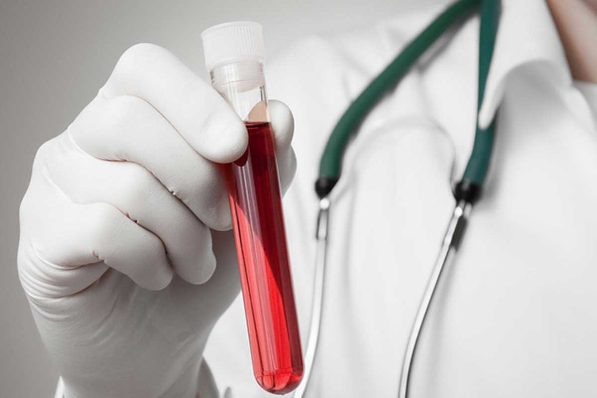 Діагностика гематологічних захворювань