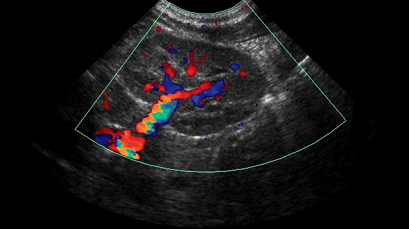 Режими УЗД судин