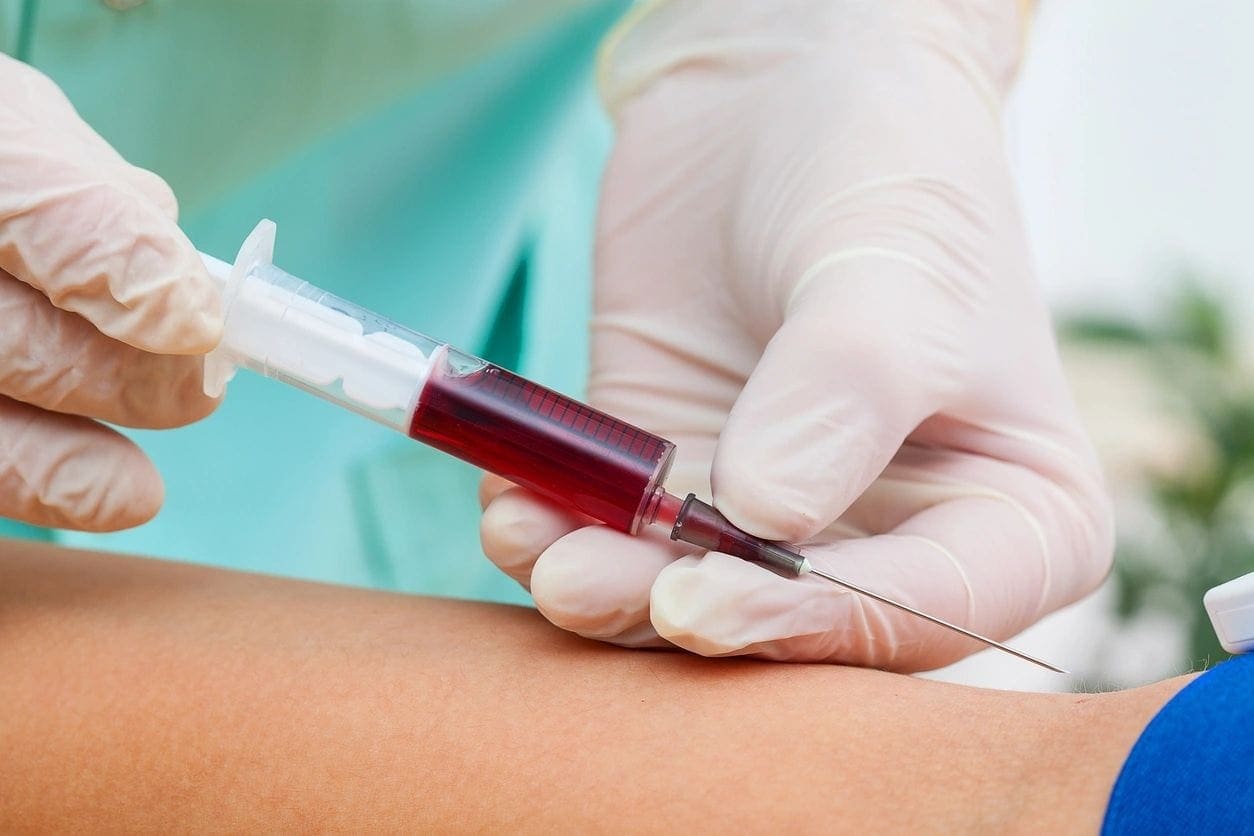 Лаборант ЄРЦ бере кров для аналізу на онкомаркери